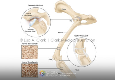 Canine hip and knee illustration